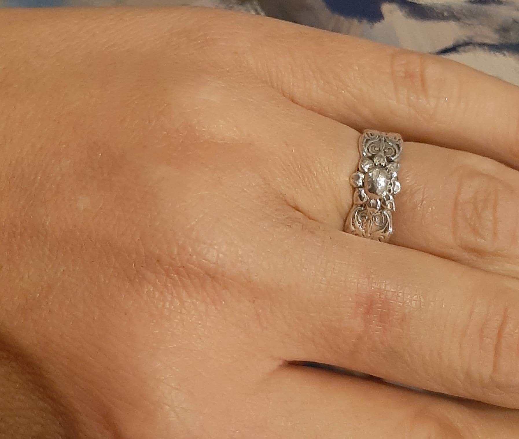 Arthritis finger MCP splint  bronze or solid sterling silver 925