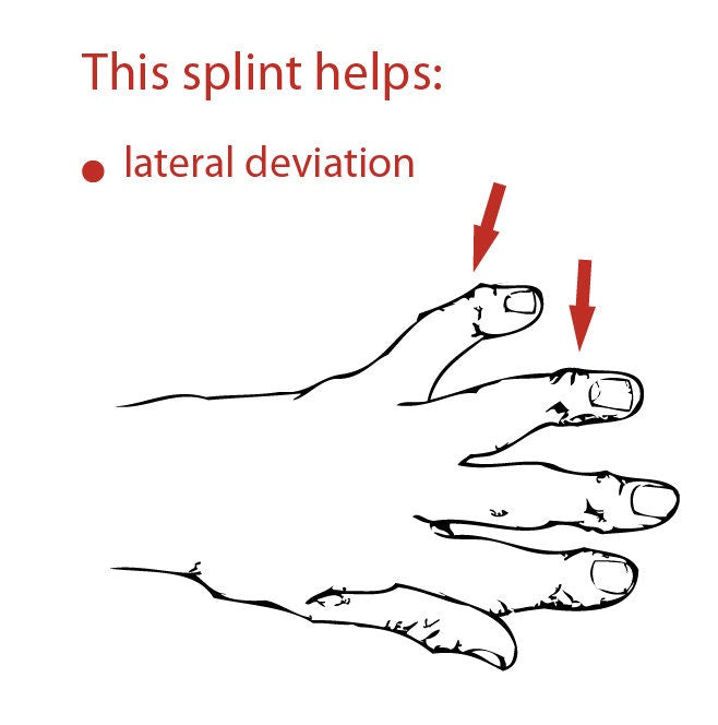 Lateral deviation finger splint for arthritis