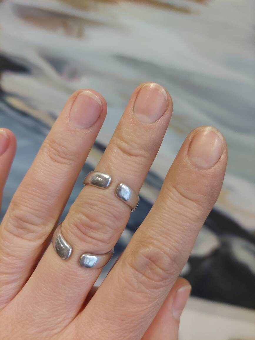 Handcrafted bronze finger splint providing front support