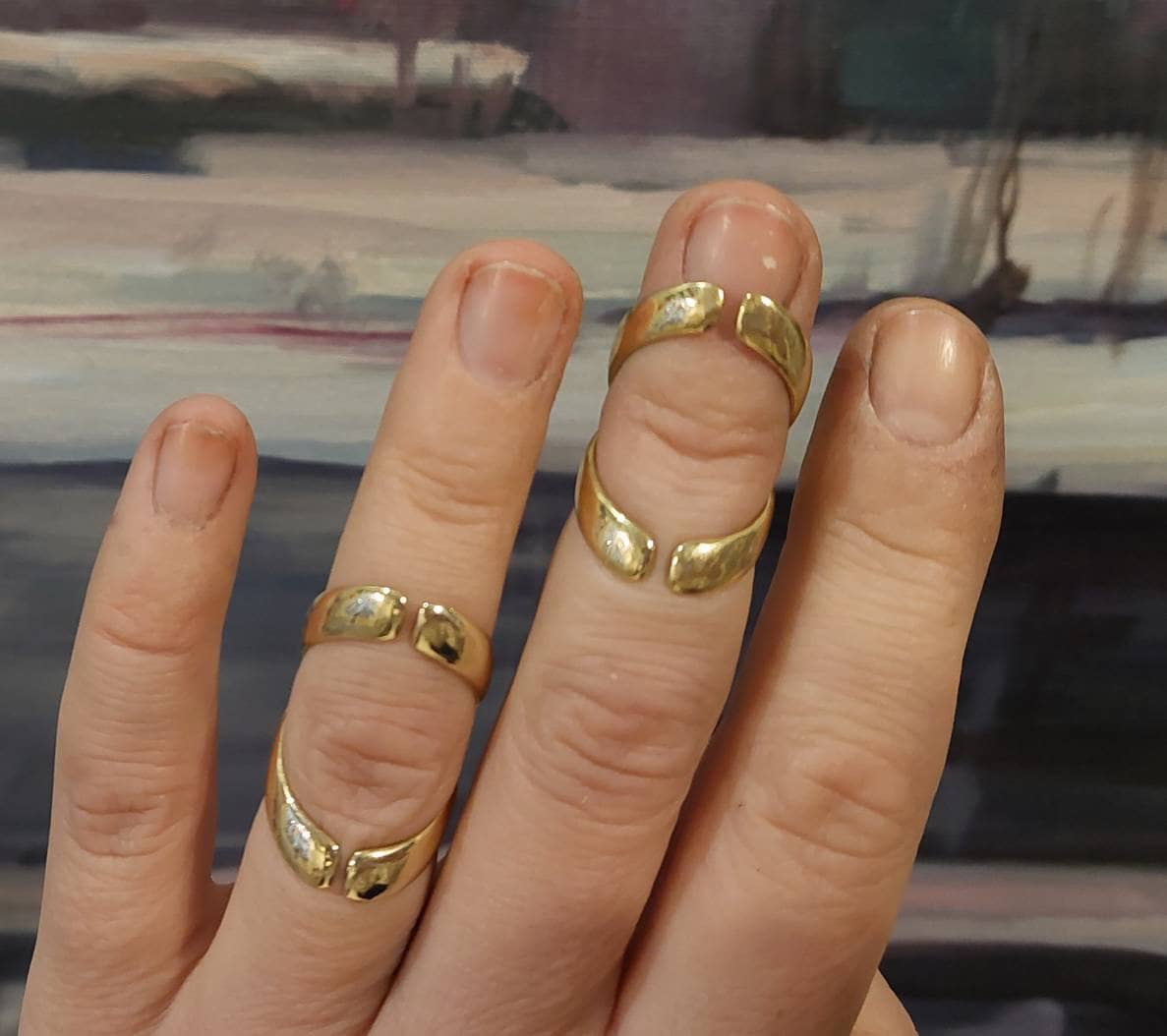 Adjustable finger splint ring available in sterling silver 925 or bronze for finger joint support