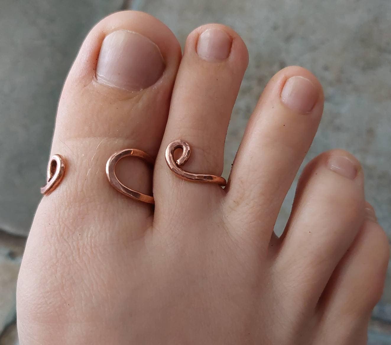 Adjustable copper toe splint with two rings designed to support toe alignment and stability