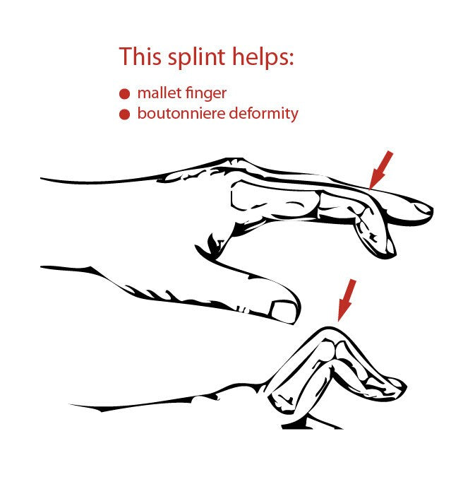 EDS finger splint sterling silver 925 for both joints adjustable