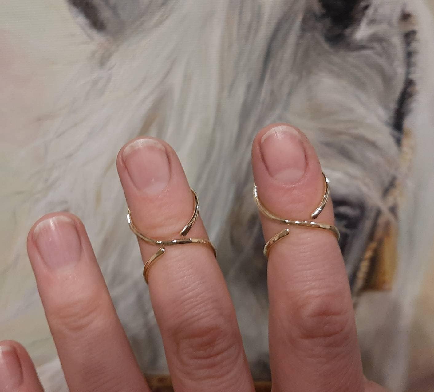 Handcrafted one-piece hammered finger splint ring designed for everyday comfort and support
