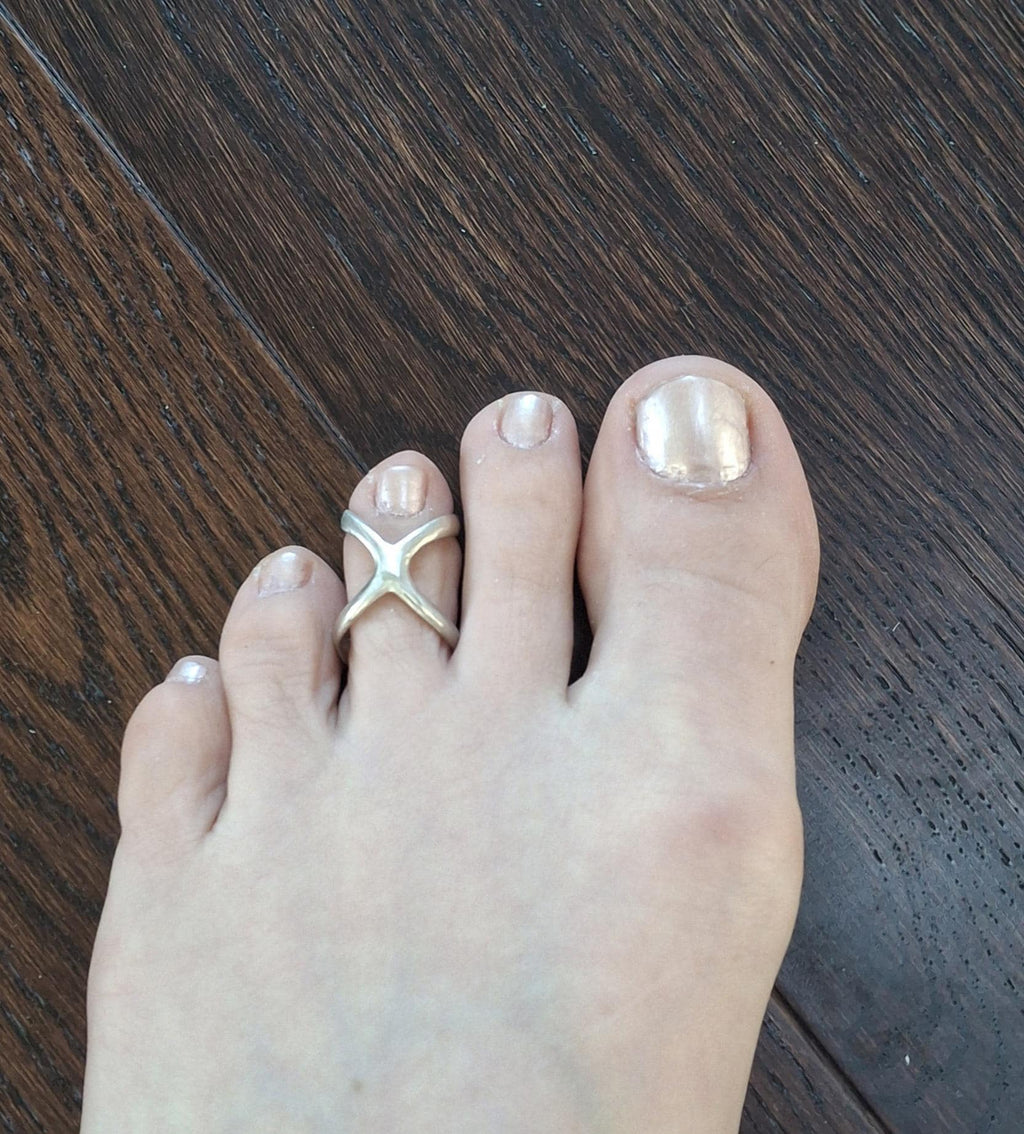 Adjustable toe splint ring worn to help maintain toe alignment and improve stability